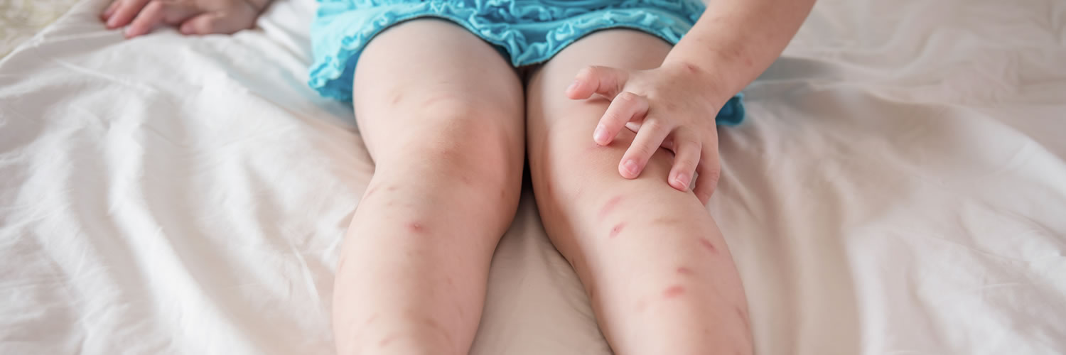 Don’t Let the Bed Bugs Bite with These Tips